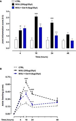 Galectin-9 Regulates Monosodium Urate Crystal-Induced Gouty Inflammation Through the Modulation of Treg/Th17 Ratio